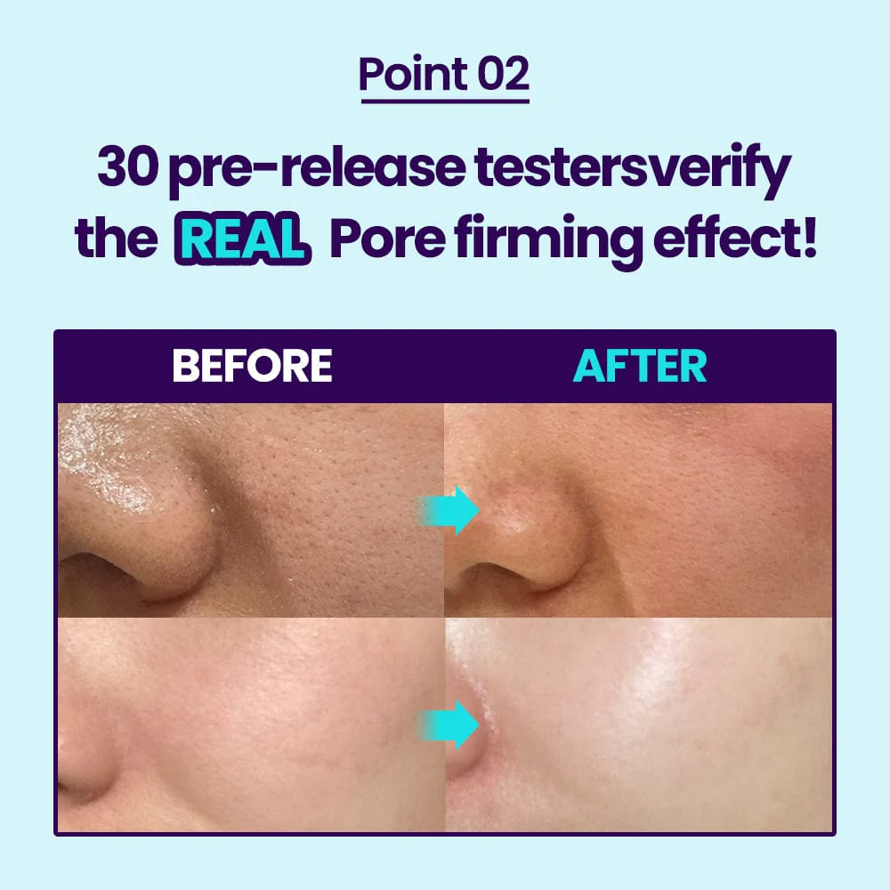 DR.G R.E.D BLEMISH BAKUCHIOL PORE-JET CREAM SPECIAL SET (50ML+10ML) - Image 5