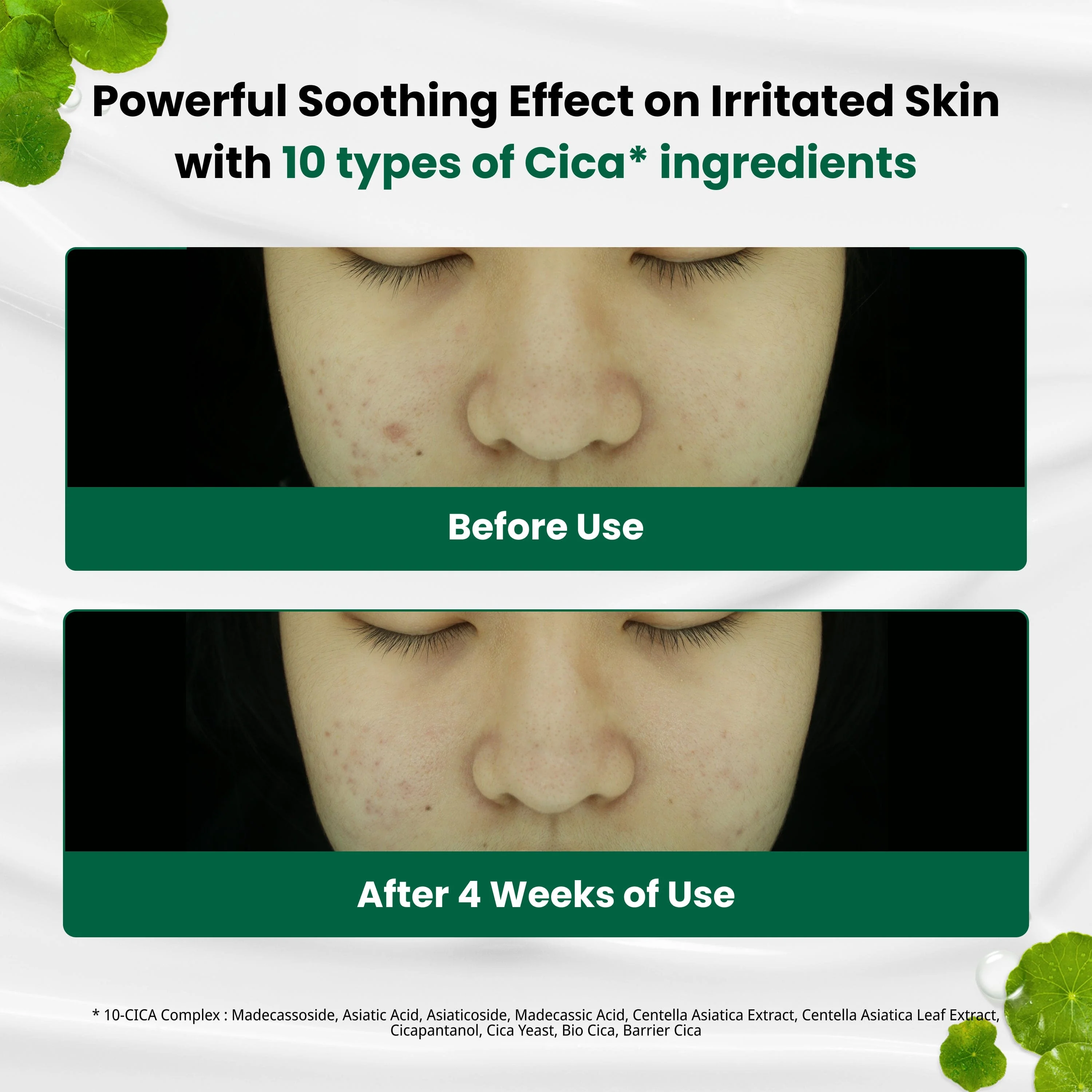 DR.G R.E.D BLEMISH CLEAR SOOTHING CREAM 70ML (TUBE) - Image 4