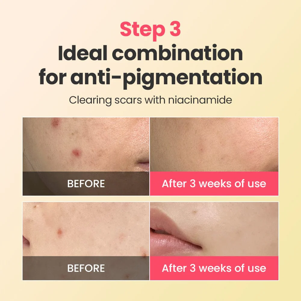 DR.G R.E.D BLEMISH REPAIR SOOTHING CREAM (50ML) - Image 5
